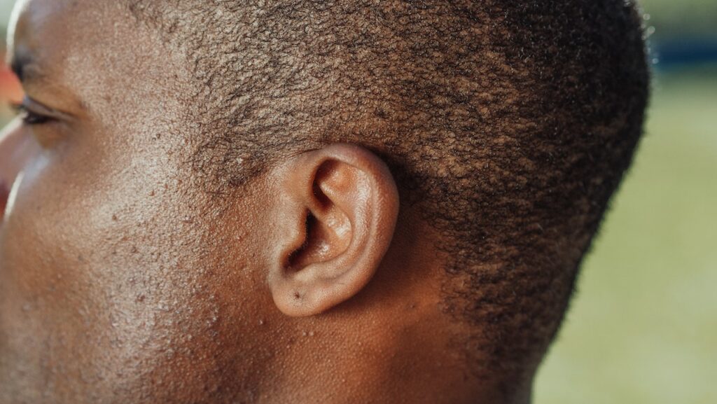 Hearing Loss